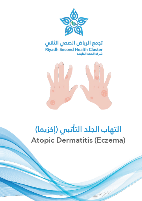 HEM2.16.000369 Eczema.pdf